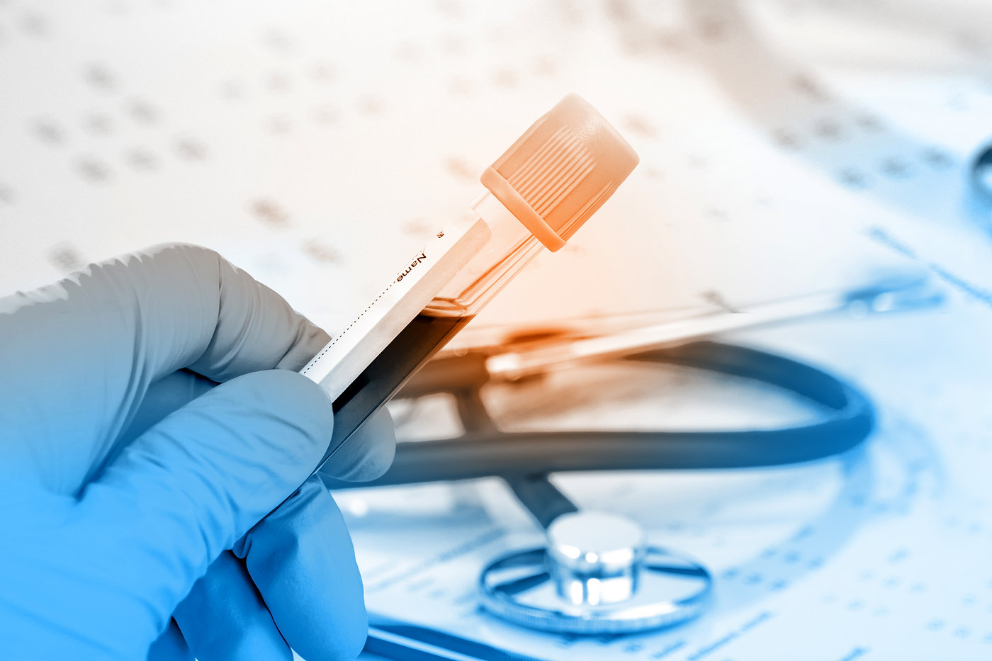 Dopamine Deficiency: Can Testing Help Diagnose ADHD?