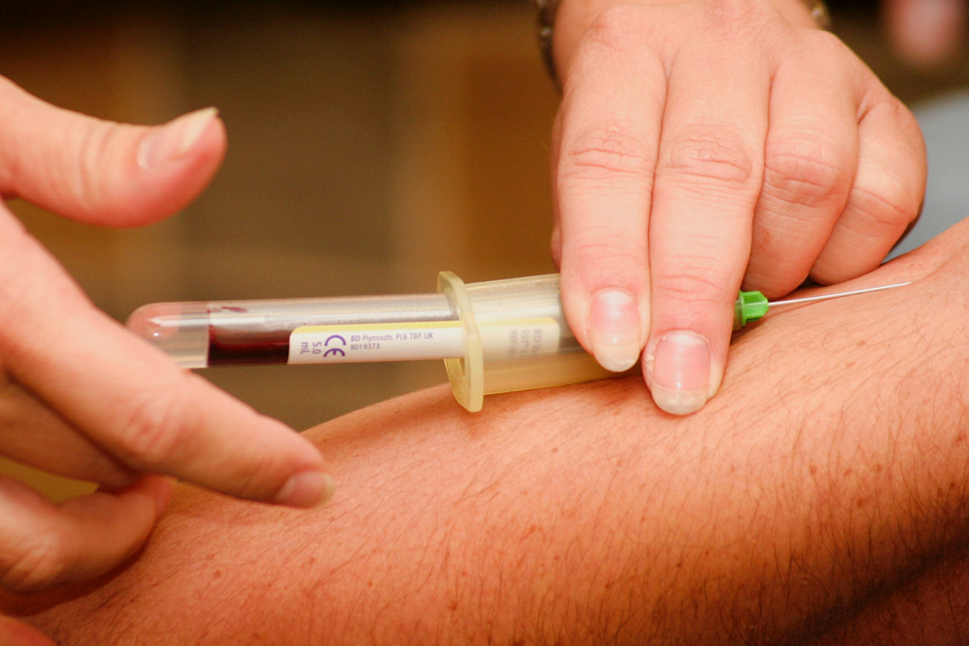 Needle in arm taking blood